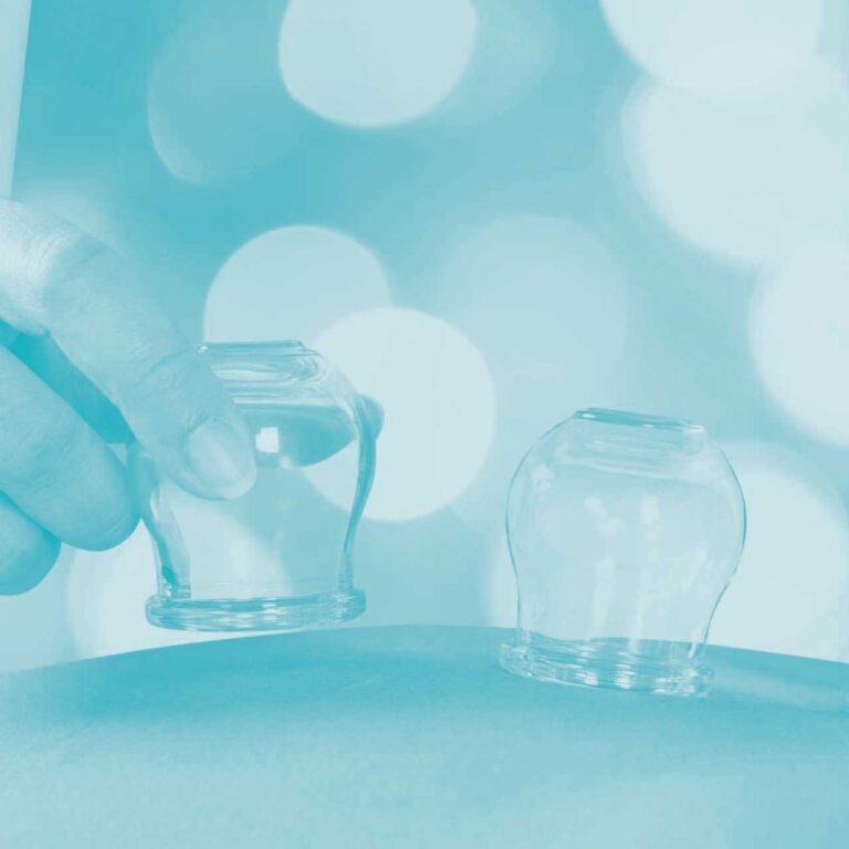 Formation à la technique de ventouses - cupping therapy - hijama
