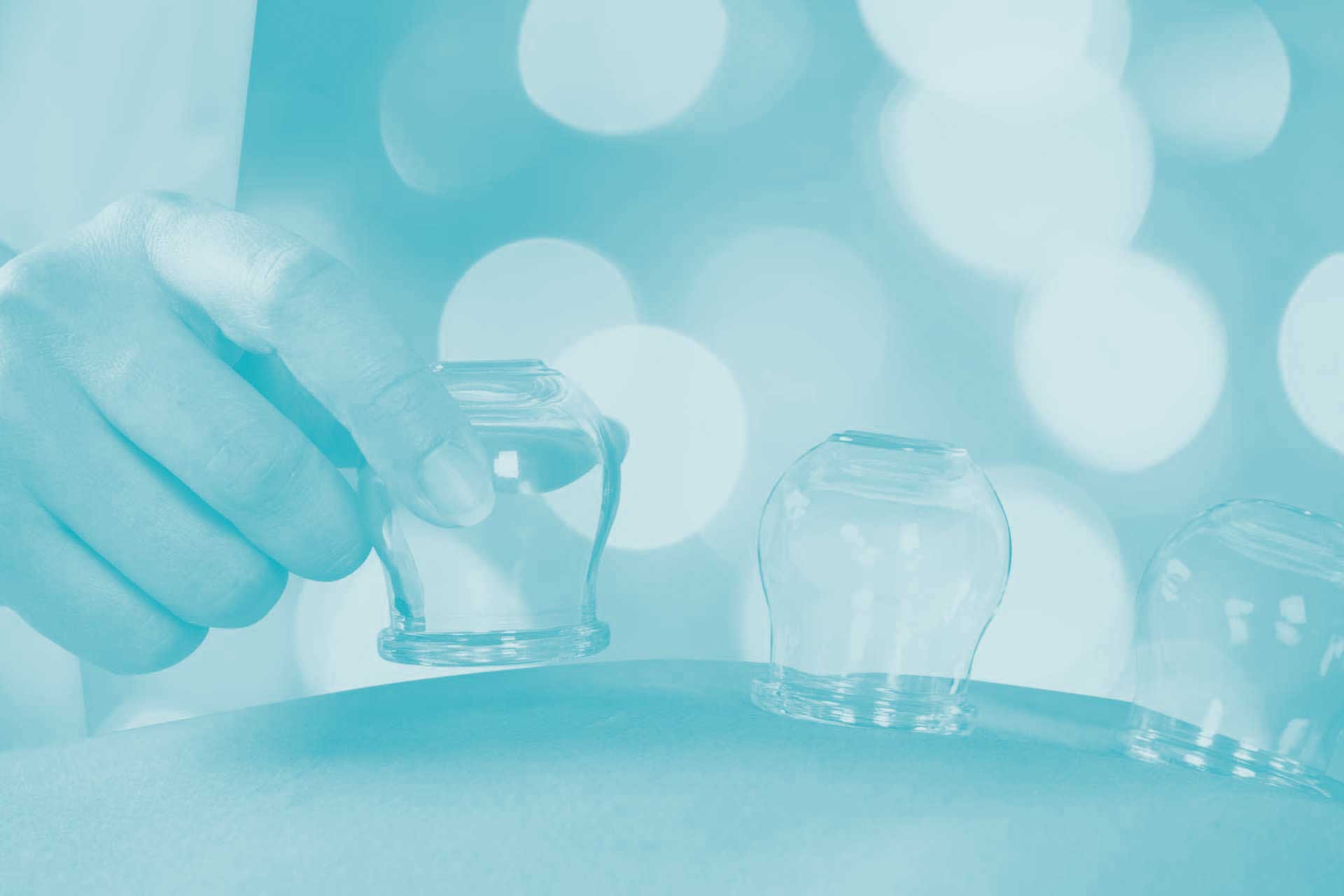 Formation à la technique de ventouses - cupping therapy - hijama