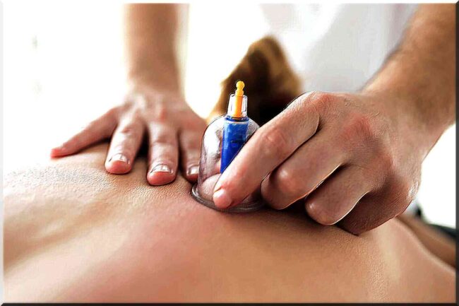 techniques ventouses