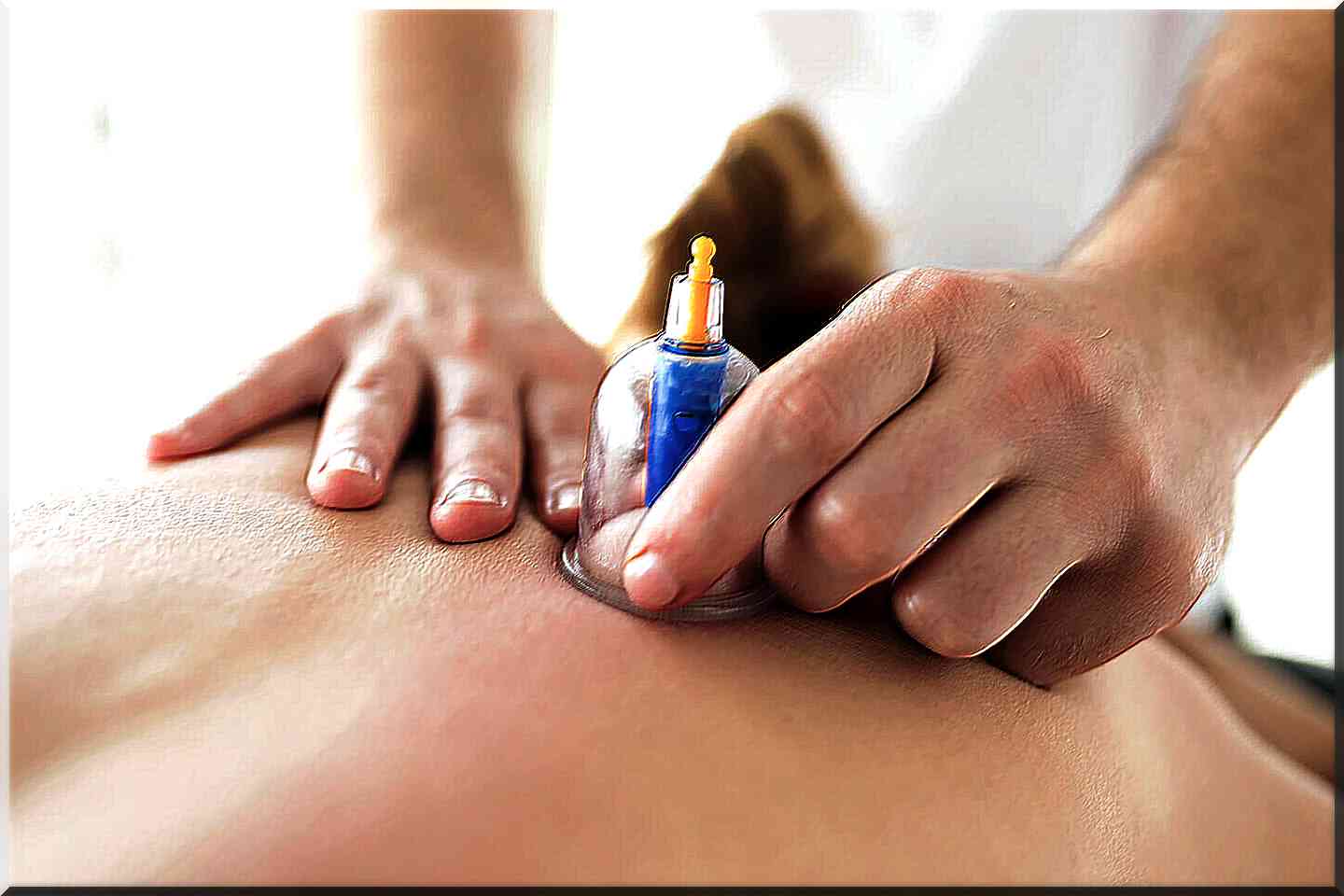 techniques ventouses